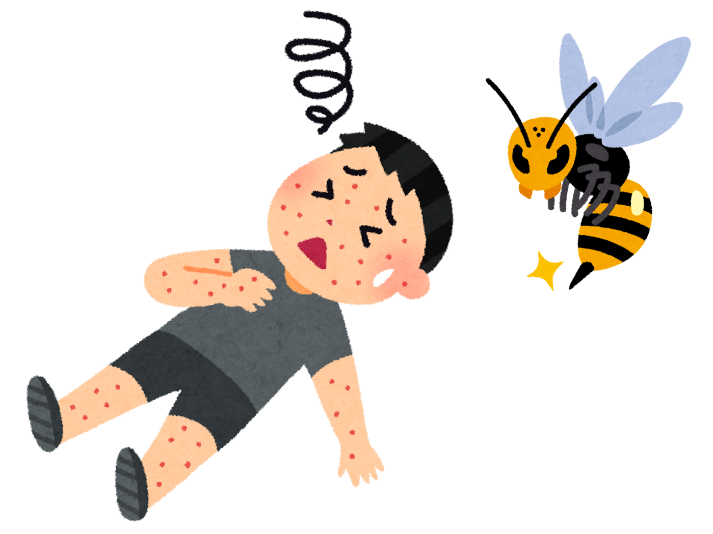 アナフィラキシー